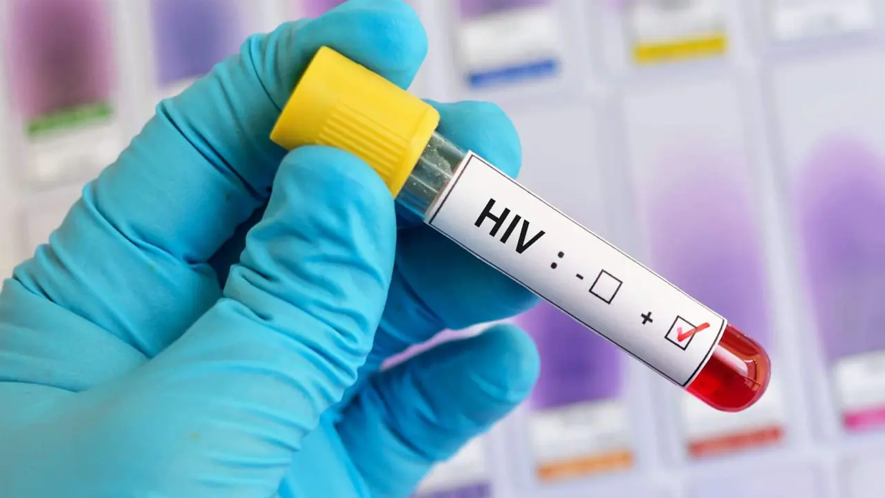 Hiv 2 20240729080106
