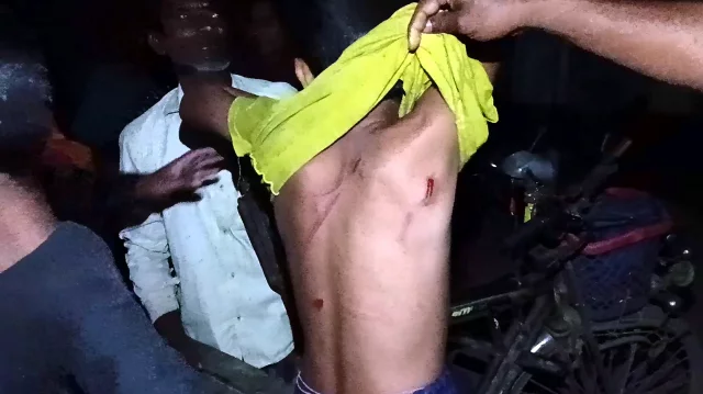 ঘুমে বিছানায় প্রসাব, মাদ্রাসা শিক্ষকের পিটুনিতে ছয় শিশু হাসপাতালে