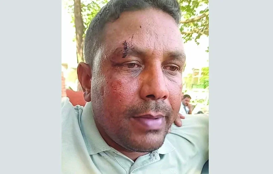 Brunei expatriate beaten up for not receiving bribe, hospitalized