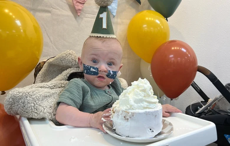 Miracle of survival of baby born at just 21 weeks