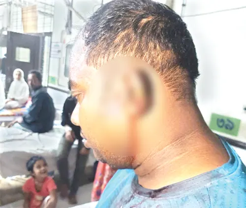 Expatriate stabbed and injured for not paying tax