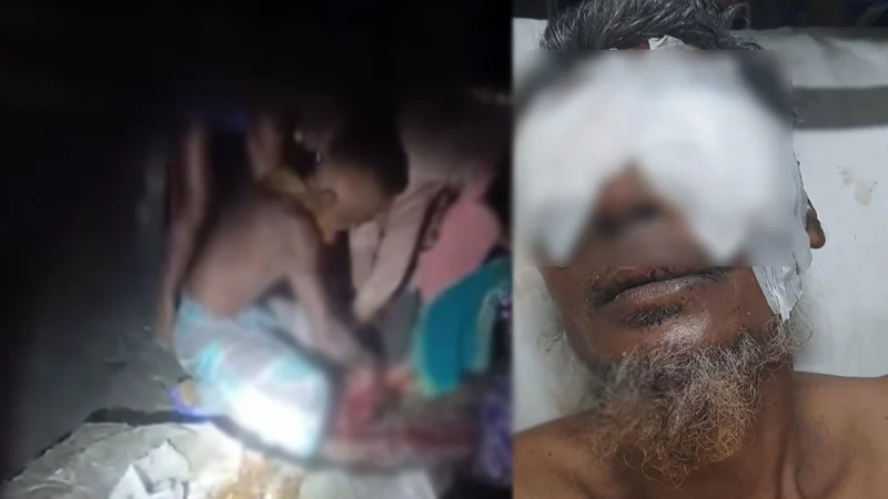 Two brothers gouged out their brother's eyes on the orders of their father