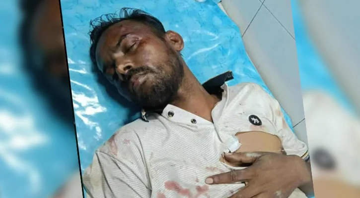 Hero alam, victim of attack, admitted to hospital