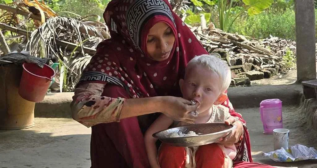 Expatriate divorces wife because child's skin and hair color are different