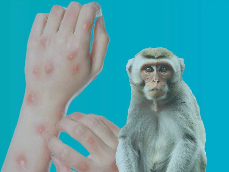 Whatsapp image 2025 11 10 at 1.13.20 pm