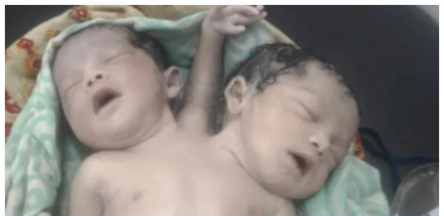 Ebbf2 2381830cdf long