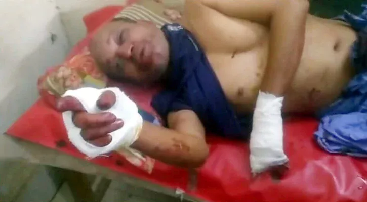 1777451471 700567ec926069fb146aa8a71c621a8d